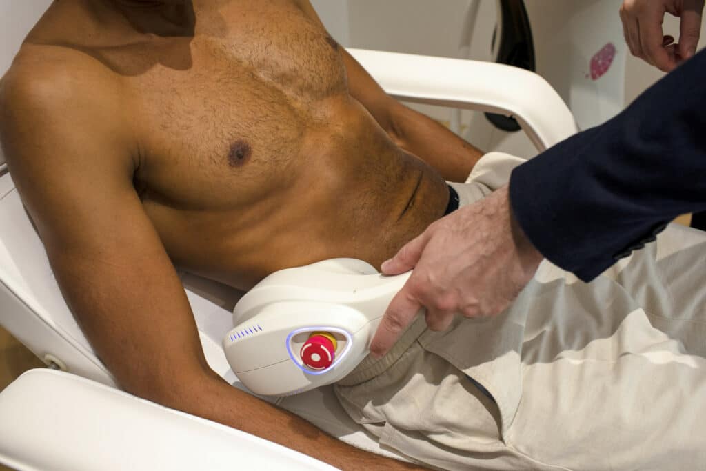 pourquoi une cryolipolyse apres l ete c est malin 