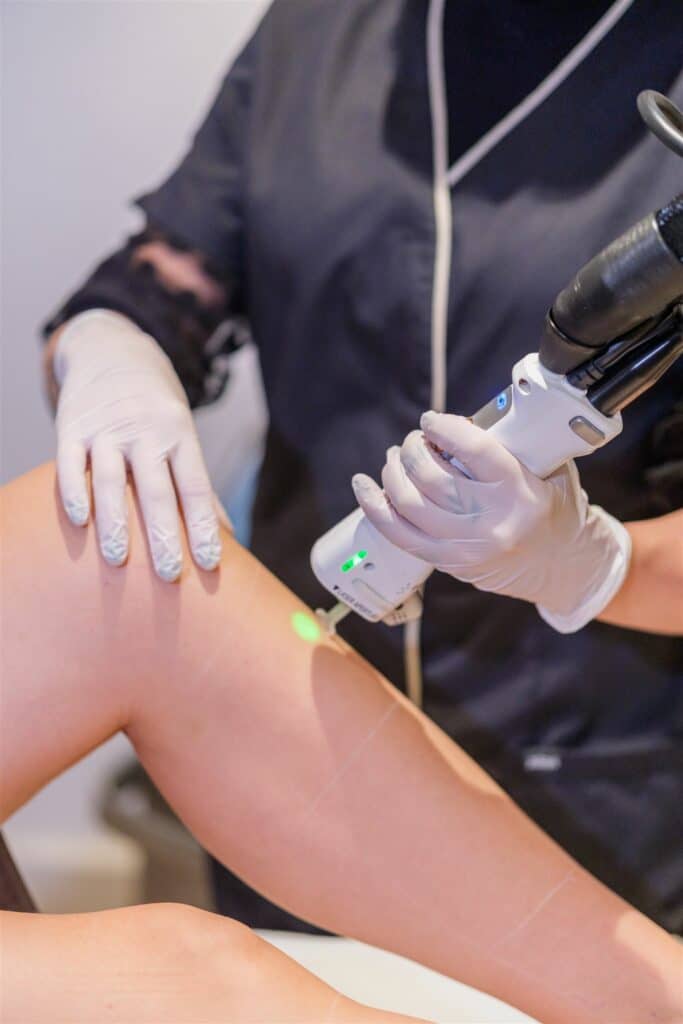 epilation laser a bordeaux | Eliskin