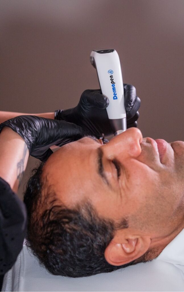 microneedling dermapen eliskin bordeaux