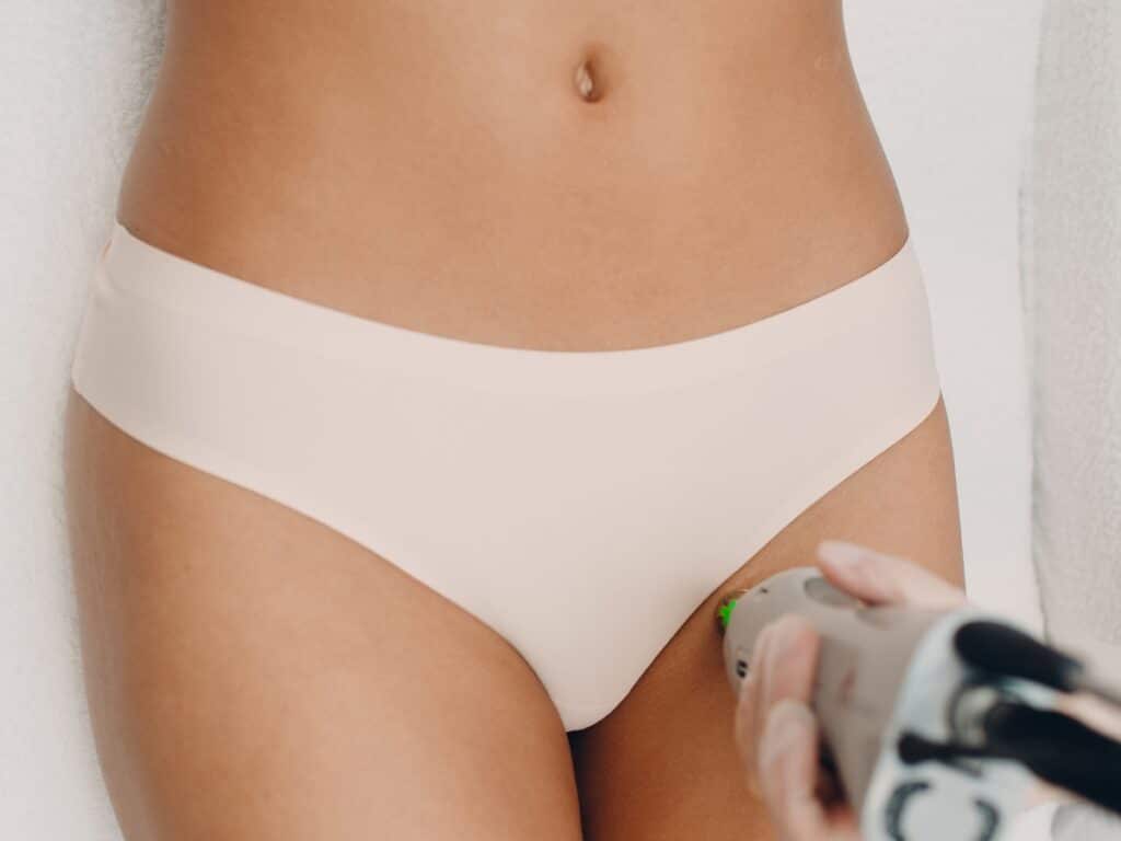 epilation laser du maillot avec le laser clarity 2 chez eliskin