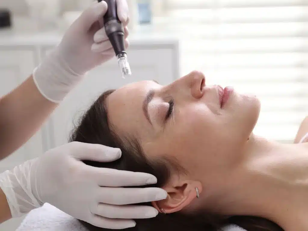 Soin anti-âge par microneedling dans un centre esthétique à Bordeaux