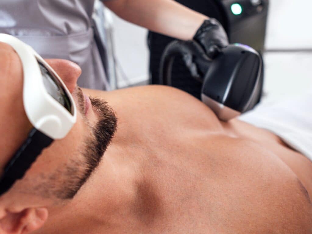 epilation laser homme technologie clarity