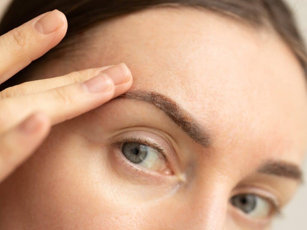 Gros plan sur les sourcils d'une femme illustrant l'épilation laser inter-sourcils au laser Clarity II à Bordeaux