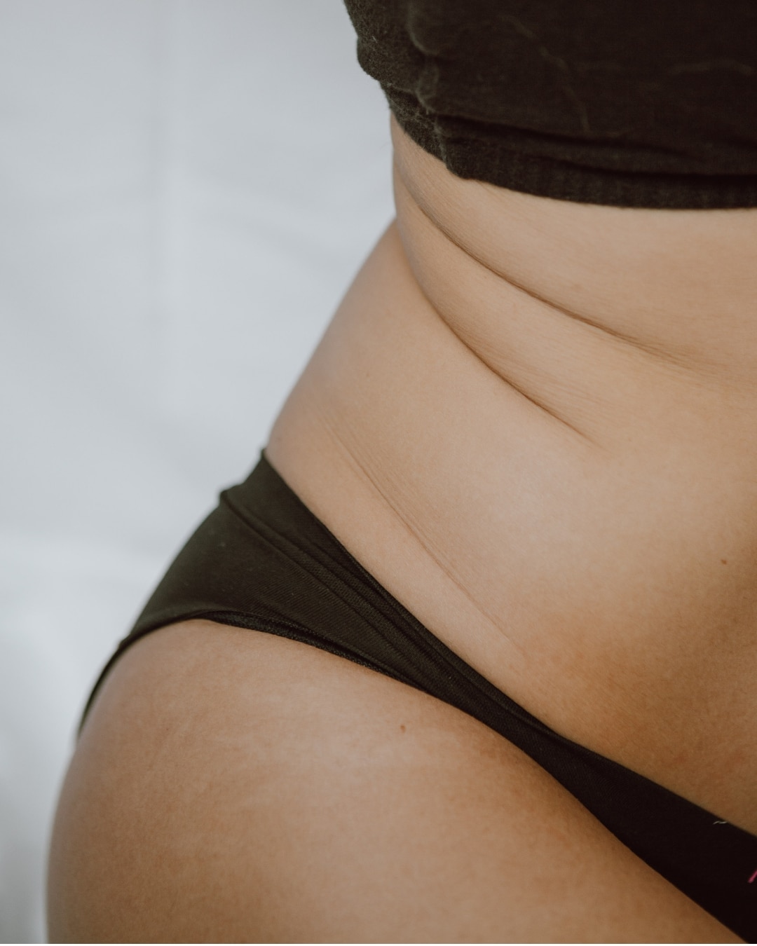 Focus sur la zone abdominale et les hanches, représentant les graisses rebelles ciblées par les traitements de dermo-esthétique pour affiner le corps