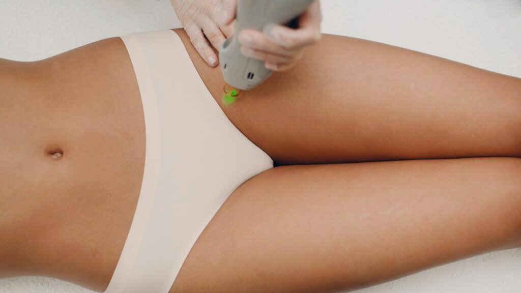 Zone epilation laser merignac